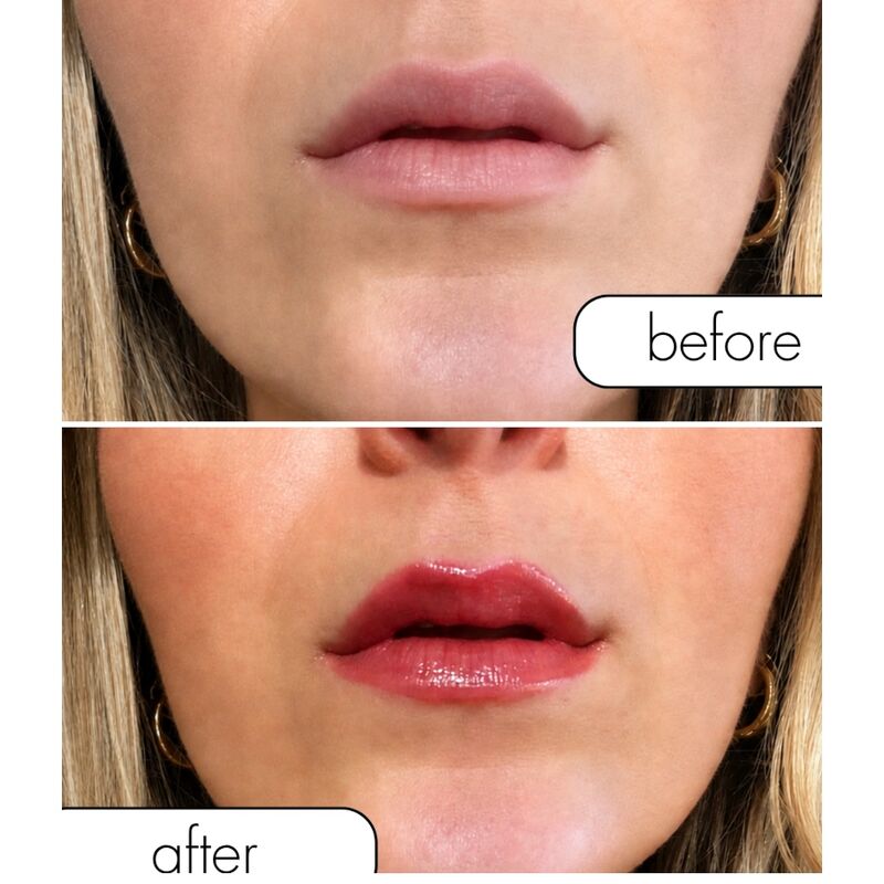 https://dreamlove.gesio.be/productos/imagenes/img_233619_13d1e42819f23e7487fd77b2353ba23a_1.jpg